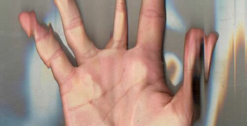 Atopos Unlocked: David Marinos